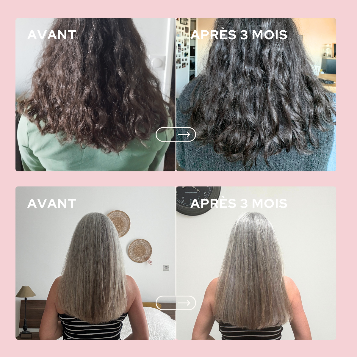 epycure-cheveux-ongles-gummies-cheveux-3-mois-pousse-brillance image 4