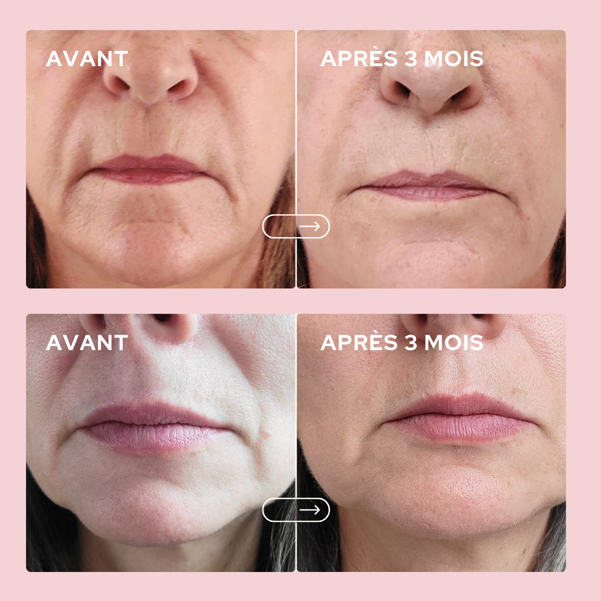 epycure-peau-solaire-duo-cure-belle-peau-clat image 4
