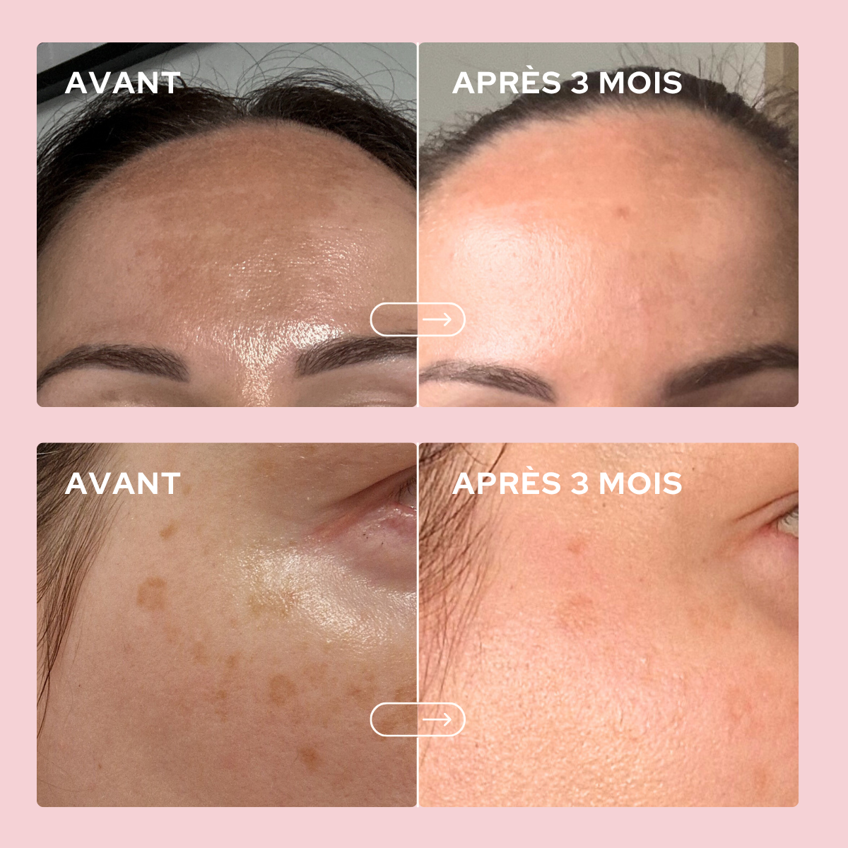 epycure-duo-belle-peau-cure-clat-1-mois image 3